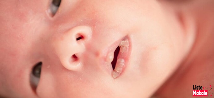 Bebeklerde Dudak Kuruluğu Nasıl Geçer?