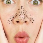 Burnumdaki Siyah Noktalardan Nasıl Kurtulabilirim?