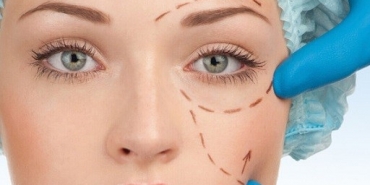 Göz Kapağı Estetiği Mersin'de Tek Adres