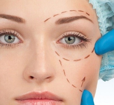 Göz Kapağı Estetiği Mersin'de Tek Adres