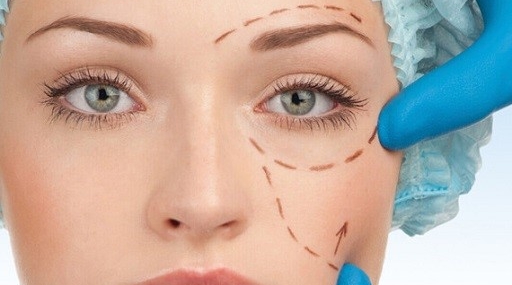 Göz Kapağı Estetiği Mersin’de Tek Adres