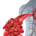 Kan Pıhtılaşmasını Önleyen Besinler
