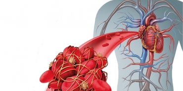 Kan Pıhtılaşmasını Önleyen Besinler