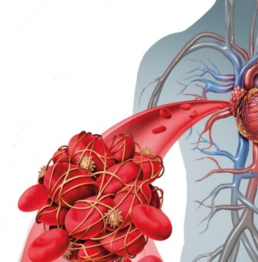 Kan Pıhtılaşmasını Önleyen Besinler