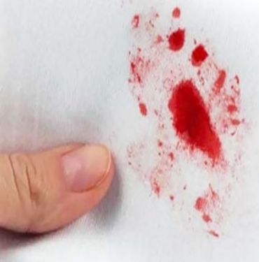 Kızlık Zarı İkinci Kez Kanar mı? 