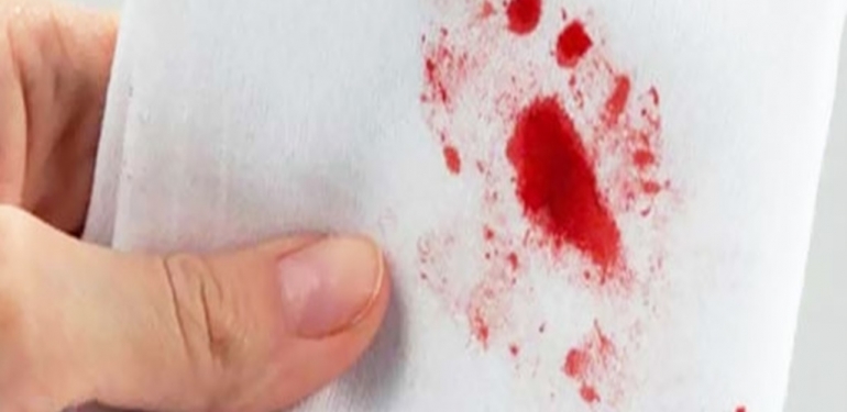 Kızlık Zarı İkinci Kez Kanar mı? 