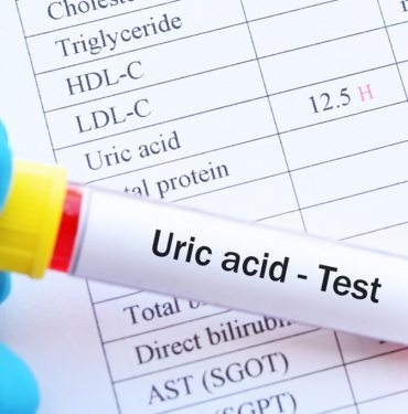 Ürik Asidin Düşmesine Yardımcı Olan Besinler