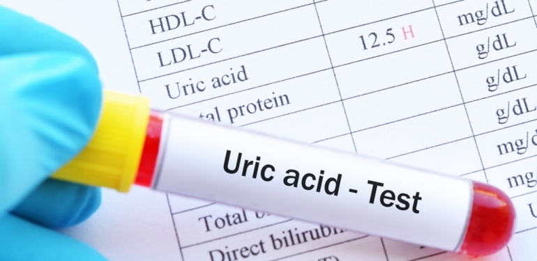 Ürik Asidin Düşmesine Yardımcı Olan Besinler