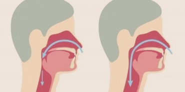 Uyku Apnesi Nedir? Uyku Apnesi Nedenleri ve Tedavisi