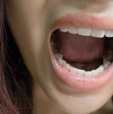 Damak Yaraları Neden Olur?  