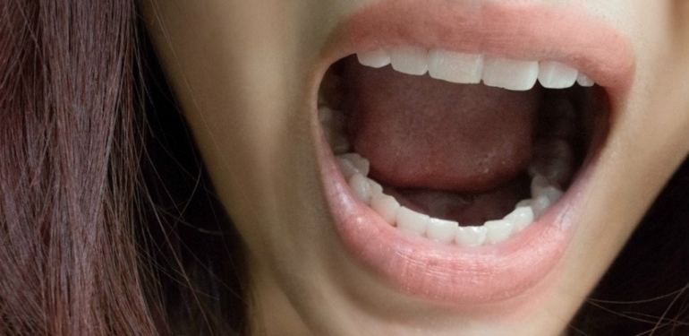 Damak Yaraları Neden Olur?  