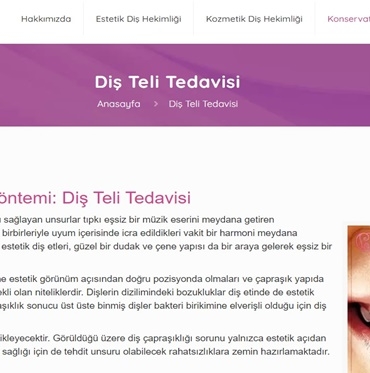 Diş Teli Fiyatlari 2022