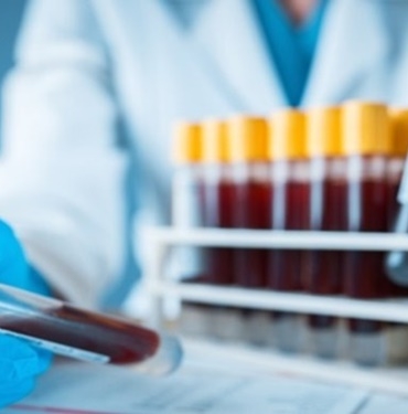 Kan Tahlili Sorgulama ve Öğrenme Nasıl Yapılır? 