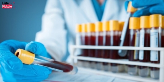 Kan Tahlili Sorgulama ve Öğrenme Nasıl Yapılır? 