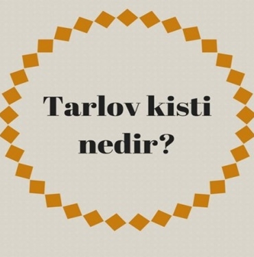 Tarlov Kisti Nedir? 