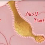Yüz Kurdu Nasıl Temizlenir? 