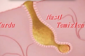 Yüz Kurdu Nasıl Temizlenir? 