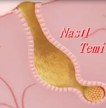 Yüz Kurdu Nasıl Temizlenir? 