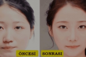 Yüz Nasıl Zayıflar? 