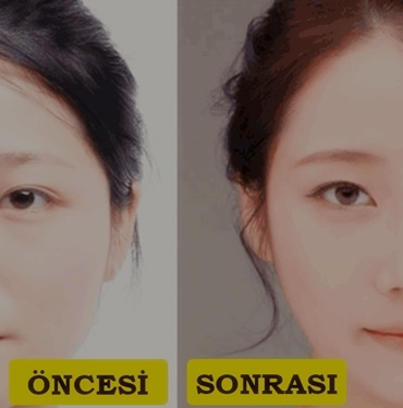 Yüz Nasıl Zayıflar? 