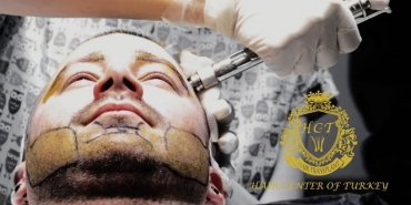 Türkiye'nin en iyi sakal ekim merkezi