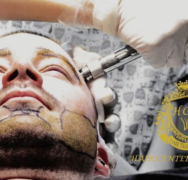 Türkiye'nin en iyi sakal ekim merkezi