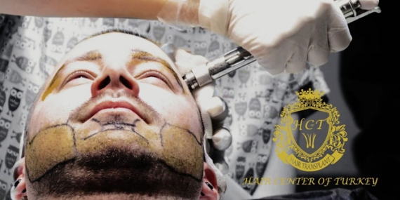 Türkiye’nin En İyi Sakal Ekim Merkezi: Hair Center of Turkey
