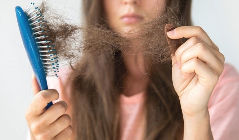 Hangi Yiyecekler Saç Dökülmesini Önler?
