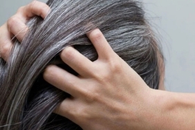 Genç Yaşta Saç Beyazlamasını Önleyen Yiyecekler