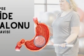 Mide Balonu Fiyatları