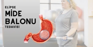 Mide Balonu Fiyatları