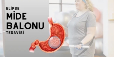 Mide Balonu Fiyatları
