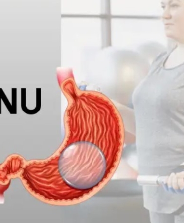 Mide Balonu Fiyatları