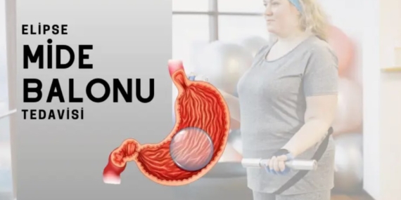 Mide Balonu Fiyatları