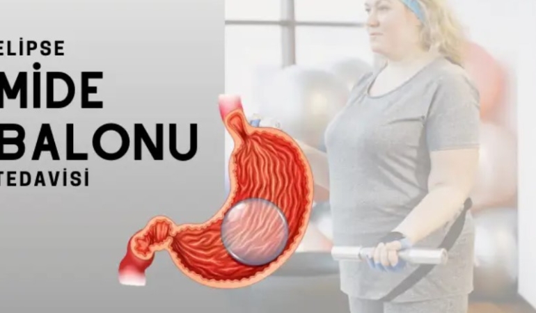 Mide Balonu Fiyatları