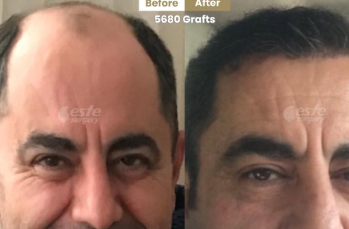 Este Surgery ile Yüksek Standartta fue